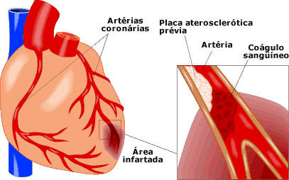 Pruebas para las cardiopatías